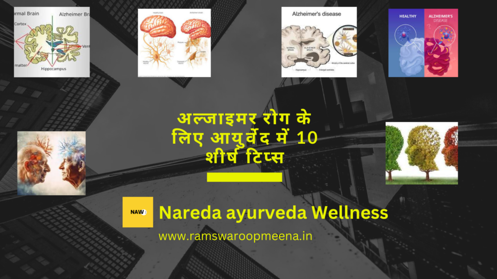 अल्जाइमर