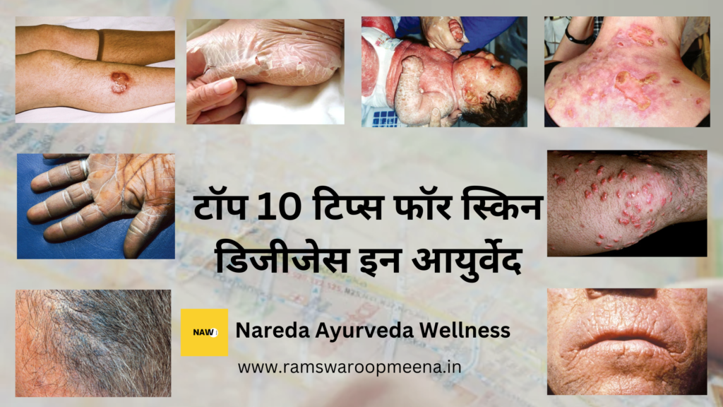 त्वचा संबंधी समस्या