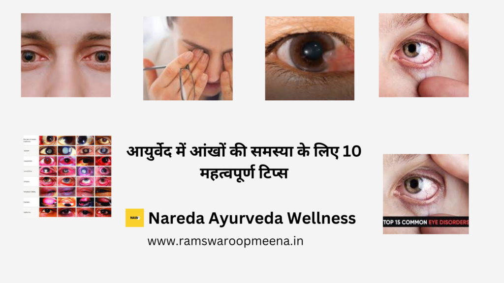 आंखों की समस्या