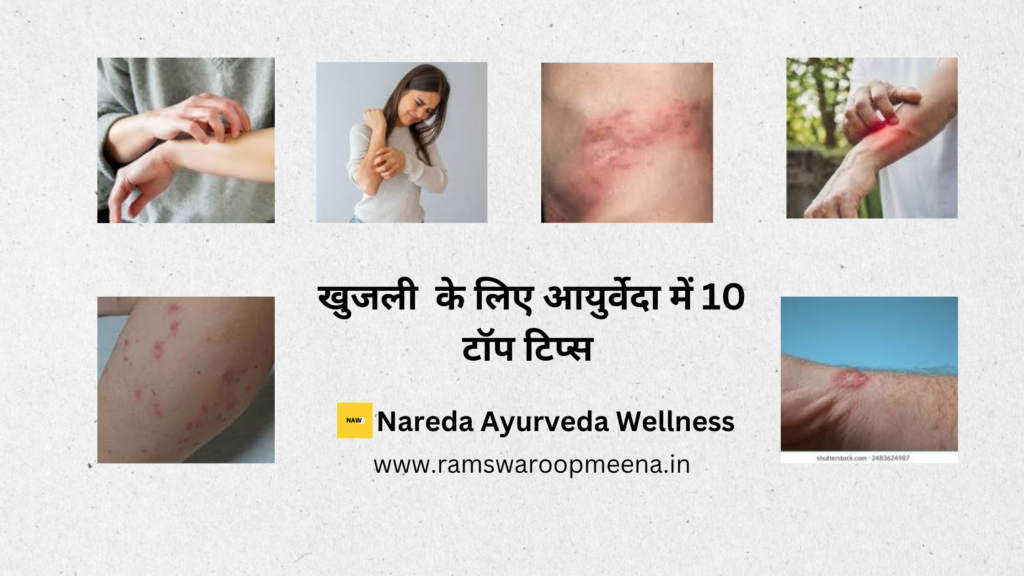 खुजली की समस्या